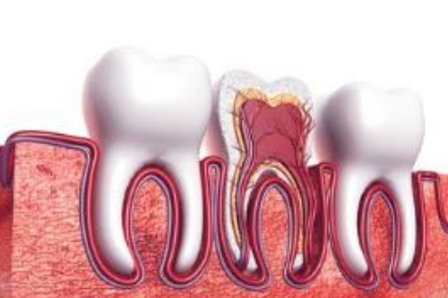 合肥根管的治疗牙齿多少钱一颗