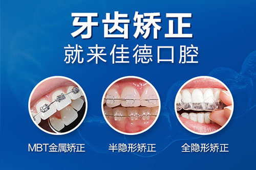 合肥市牙齿修正牙科哪家比较靠谱啊？