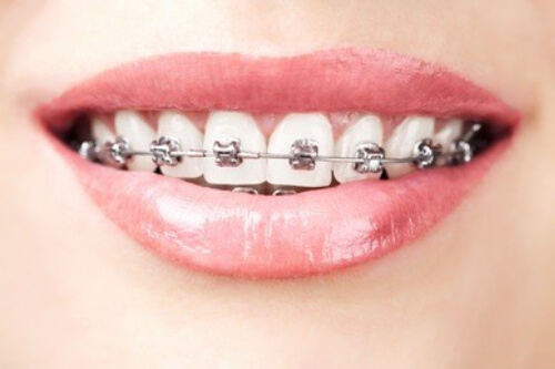 合肥市牙齿修正牙科哪家口腔比较靠谱啊？