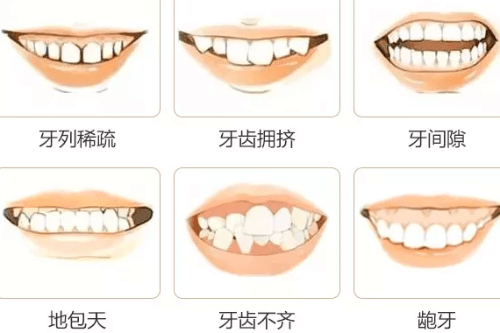 合肥牙齿矫正费用大概是多少？