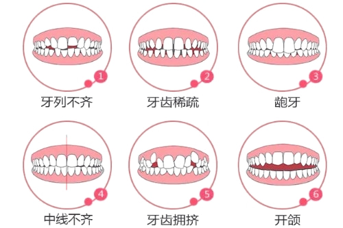 合肥整牙哪家口腔好