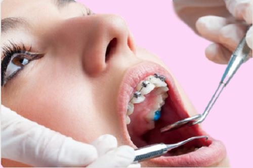 合肥包河区牙齿矫正牙科-推荐哪家？