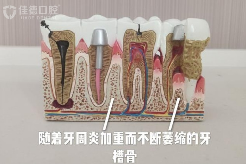 合肥洗牙哪个医院比较好