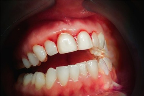 合肥看牙科哪家口腔比较好？