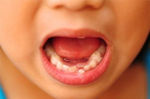 合肥儿童看牙齿哪里比较好