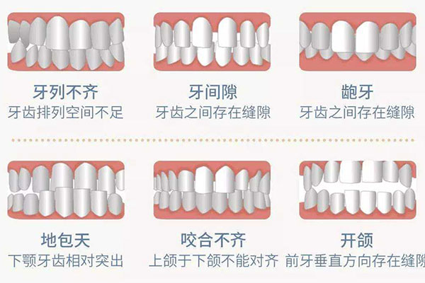 合肥隐形矫正