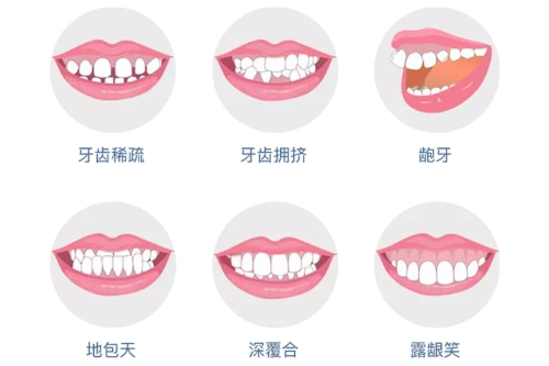 合肥牙齿矫正哪家好