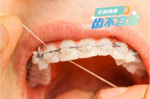 合肥牙齿矫正、牙齿矫正费用