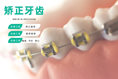 合肥牙齿矫正医院