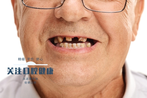 合肥种植牙修复、种植牙修复