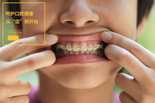 合肥矫正牙齿哪家医院比较好