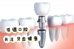 合肥种植牙需要多少钱—良心价格表分享？