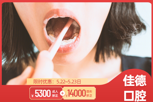 合肥佳德口腔优惠活动
