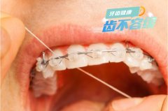合肥学生牙齿矫正大概要多少钱-拿学生证有优惠吗