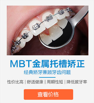 MBT金属托槽矫正