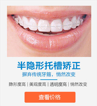 半隐形托槽矫正