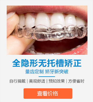 全隐形无托槽矫正