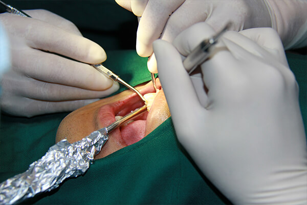 合肥做牙齿矫正修复的过程有哪些？