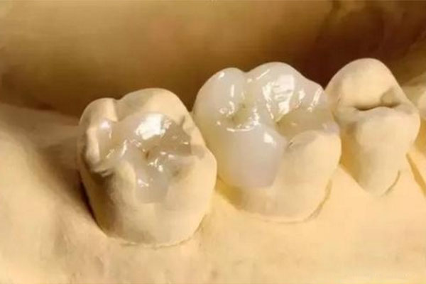 合肥补牙哪个医院好？