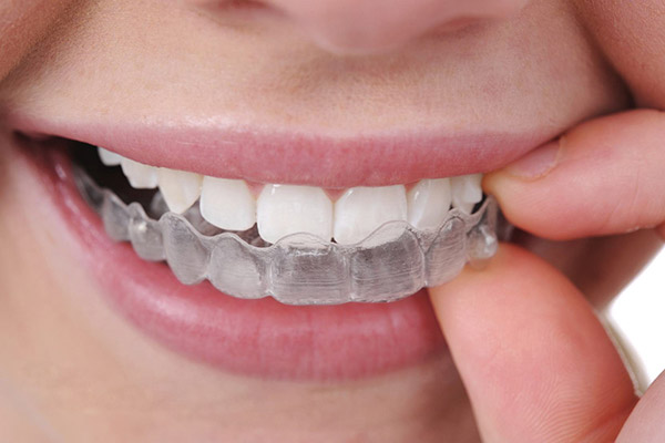 合肥牙齿纠正多少钱？