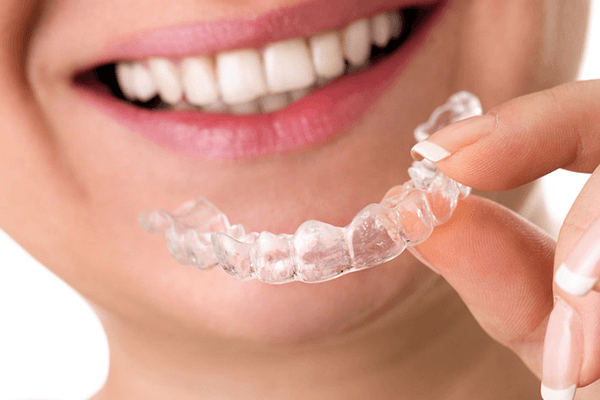 合肥隐形牙齿纠正多少钱？