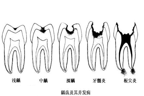 补牙