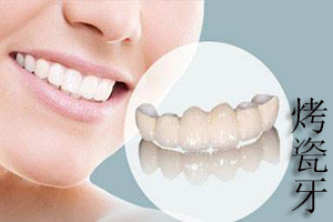 合肥烤瓷牙种类和修复牙齿的优缺点