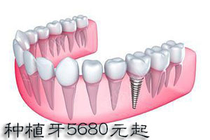 牙齿断了该怎么办？