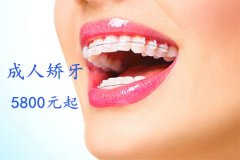 合肥整牙的费用多少？