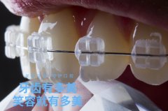 合肥牙齿矫正哪家好-牙好才是真的好