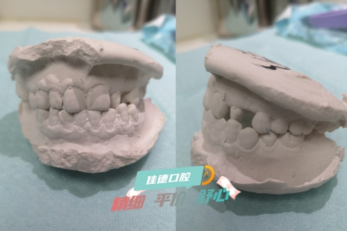 佳德口腔、佳德口腔牙齿矫正、牙齿矫正