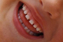 孩子牙齿发黑的原因有哪些