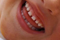 关爱孩子就关心儿童牙齿健康