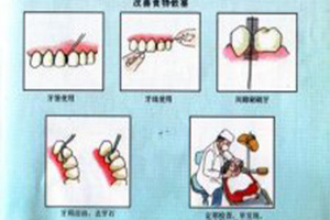 洗牙是怎么一回事