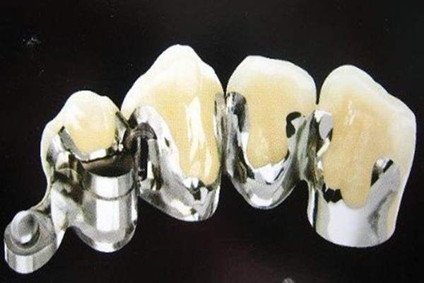 简述活动义齿修复的特点有哪些？