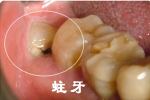 合肥拔牙哪里好_佳德口腔正规平价