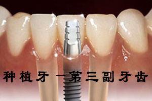 合肥种植牙一般需要多少钱?