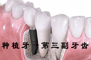种植牙的价格与哪些因素有关?