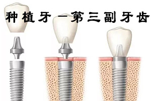 合肥做镶牙修复要多少钱？