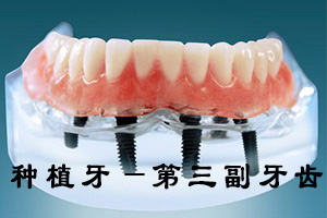 镶一颗牙需要多少钱?
