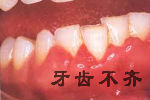 牙齿问题的原因及治疗是什么?