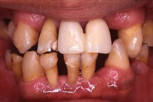 形成牙齿疾病的原因是什么？