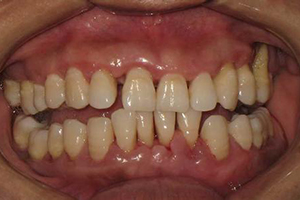  牙齿问题的治疗计划是什么？