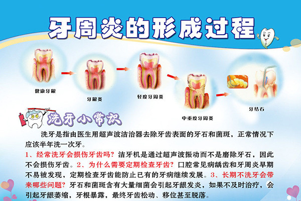 在合肥洗牙要注意规避哪些误区？