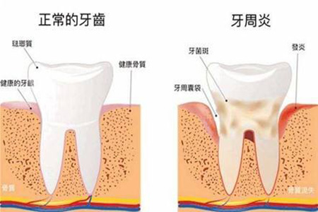 牙周炎具有哪些特征？