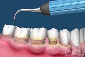 牙齿出血有危害吗