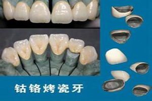 判断烤瓷牙做的好不好？