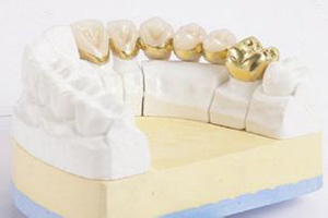 活动义齿与固定义齿的区别在哪儿？