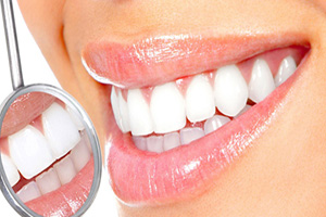 在合肥活动义齿的优点有哪些？