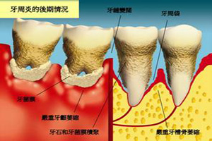  合肥包河区牙齿问题治疗哪家好？